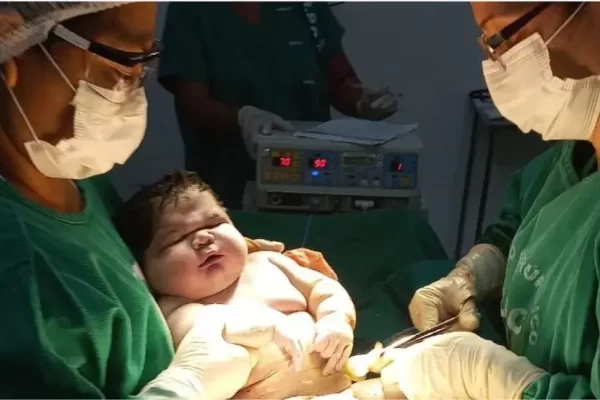 Bebê nasce com 7kg e bate recorde no Amazonas