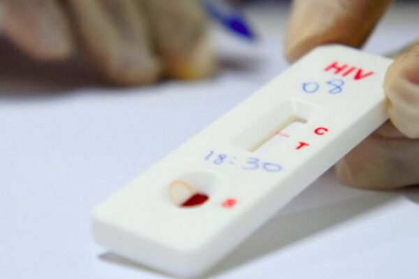 Testes gratuitos serão realizados em Caxias do Sul marcando o Dia Mundial da Luta Contra a Aids
