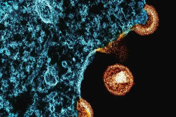 Nova variante de HIV é encontrada no RS e em outros dois estados