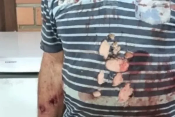Morador é atacado por puma e salvo por cães em Maquiné
